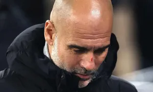 Vì sao Guardiola có nhiều vết xước trên mặt? Vì sao Guardiola có nhiều vết xước trên mặt?