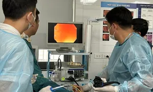 AI phát hiện sớm ung thư đường tiêu hóa