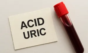 Chỉ số acid uric bao nhiêu cảnh báo bệnh gout? Chỉ số acid uric bao nhiêu cảnh báo bệnh gout?